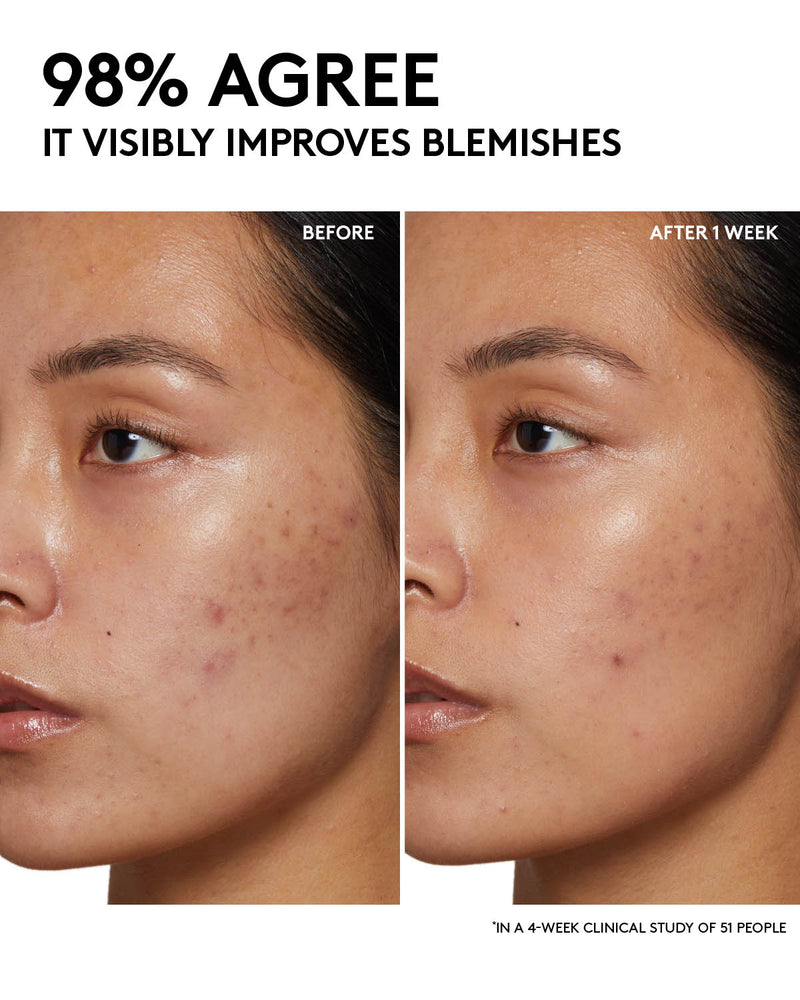 Before and after infographic picturing minimized blemishes. Copy reads 98% agree it visibly improves blemishes in a 4 week clinical study on 51 people.