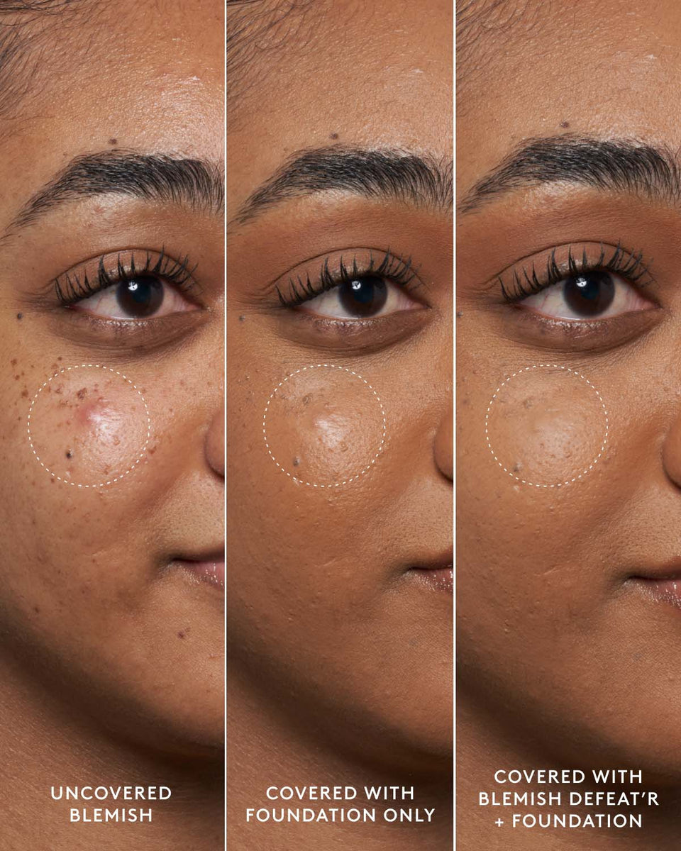 Beautiful Blemish Skin Picture for Desktop Beautiful Blemish Skin Picture for Desktop